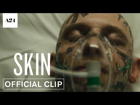 Skin (Clip 'In the Hospital')