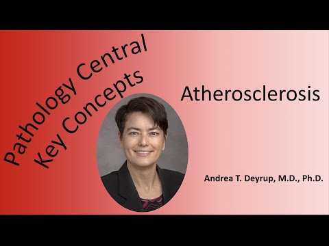 Medical School Pathology: The Pathophysiology of Atherosclerosis