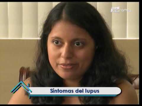Tratamientos contra el lupus 