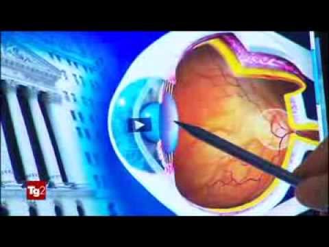 Il pigmentary nota su una faccia che trattare La decolorazione di pacchi di faccia di fango