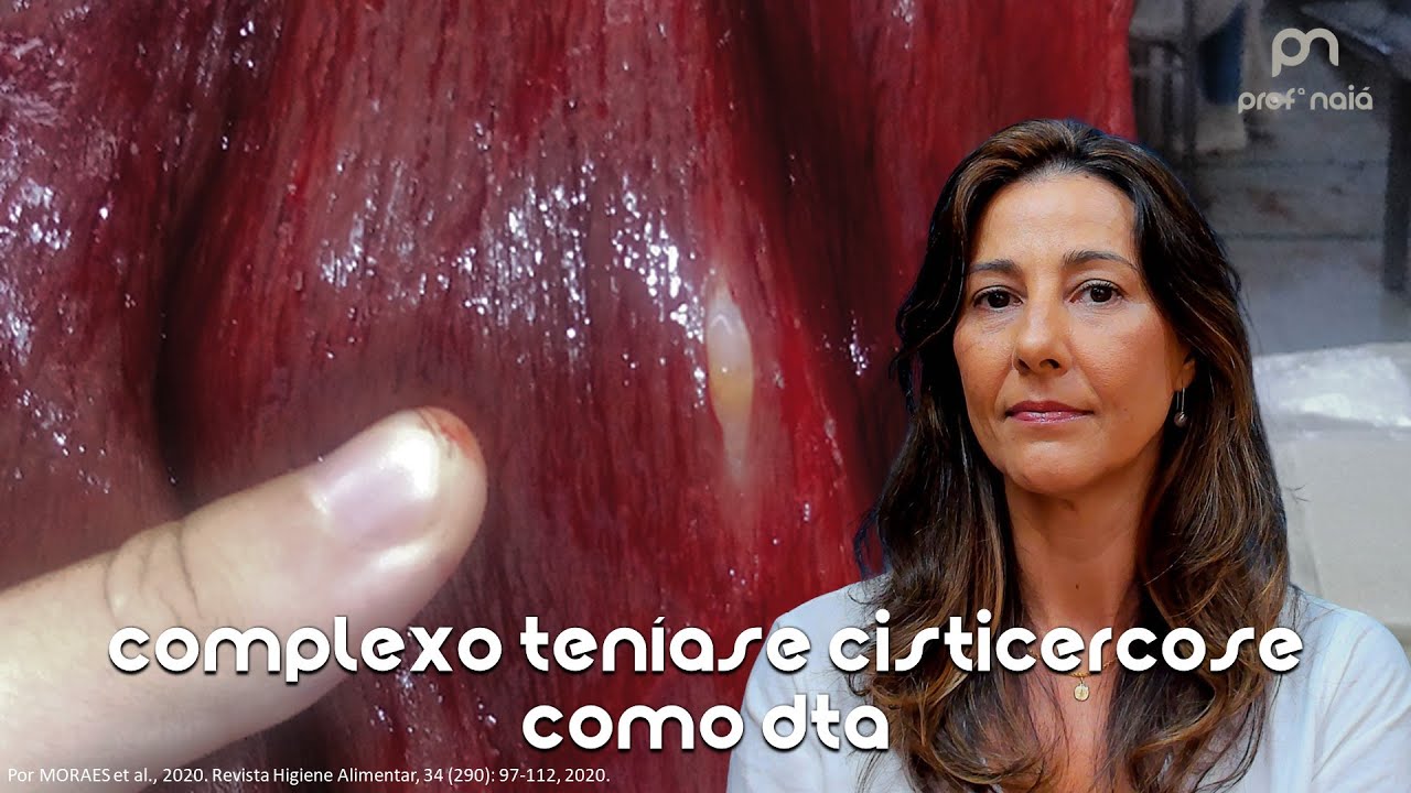 Complexo teníase-cisticercose: uma importante DTA
