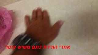 הורדת  כתם כתמים משיש קיסר 050-6496875
