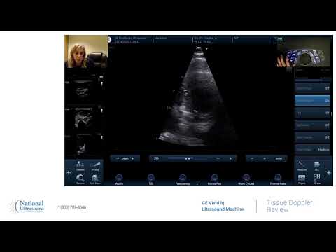 GE Vivid IQ Tissue Doppler Training Video