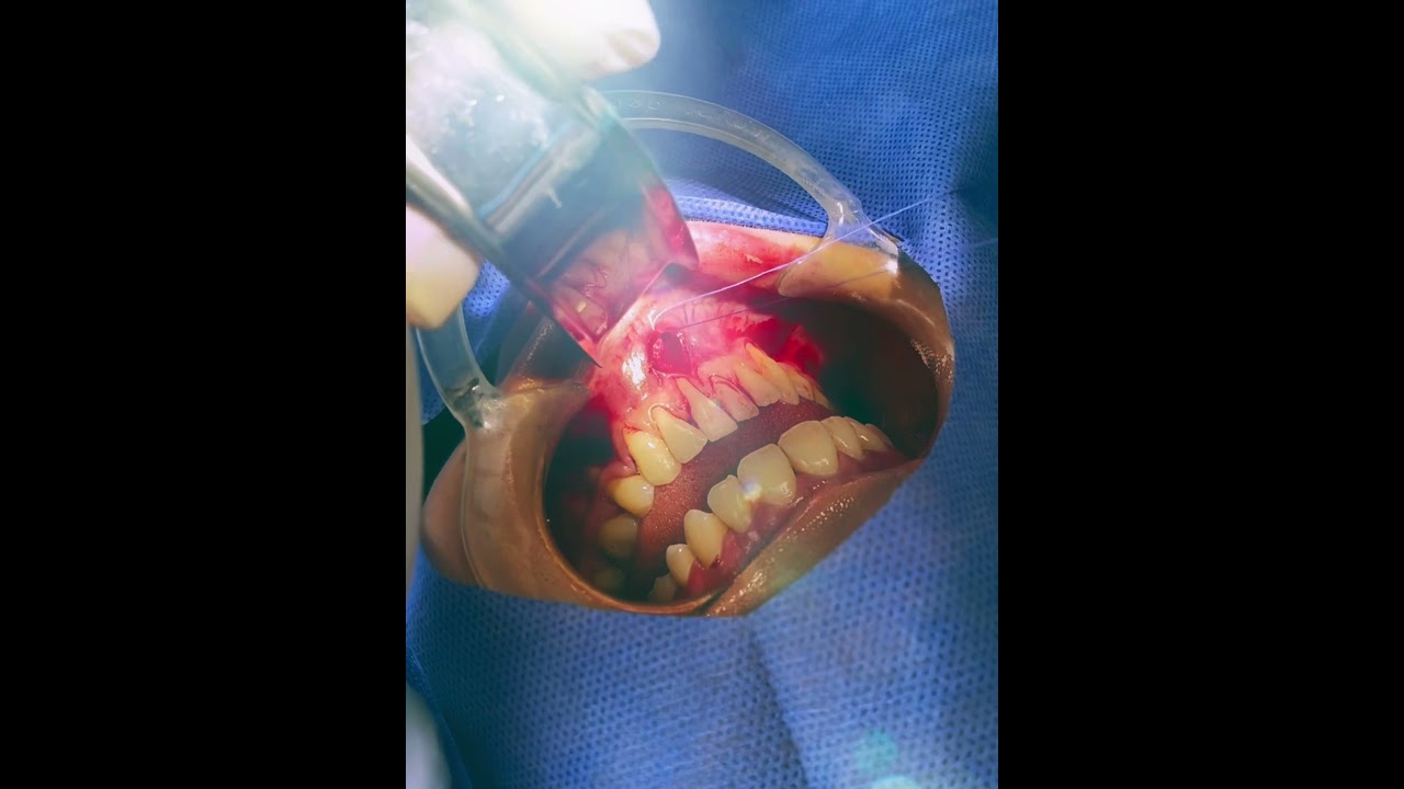 Luisa Fernanda Gomez Reyes-124