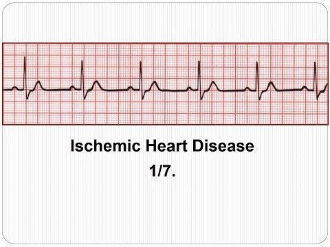 ECG Ischemic Heart Disease 1/7: Introduction