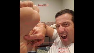 Foot Pain, Top of Foot Pain, Self Diagnose Foot Pain,  Ball of Foot Pain, Metatarsal Pain