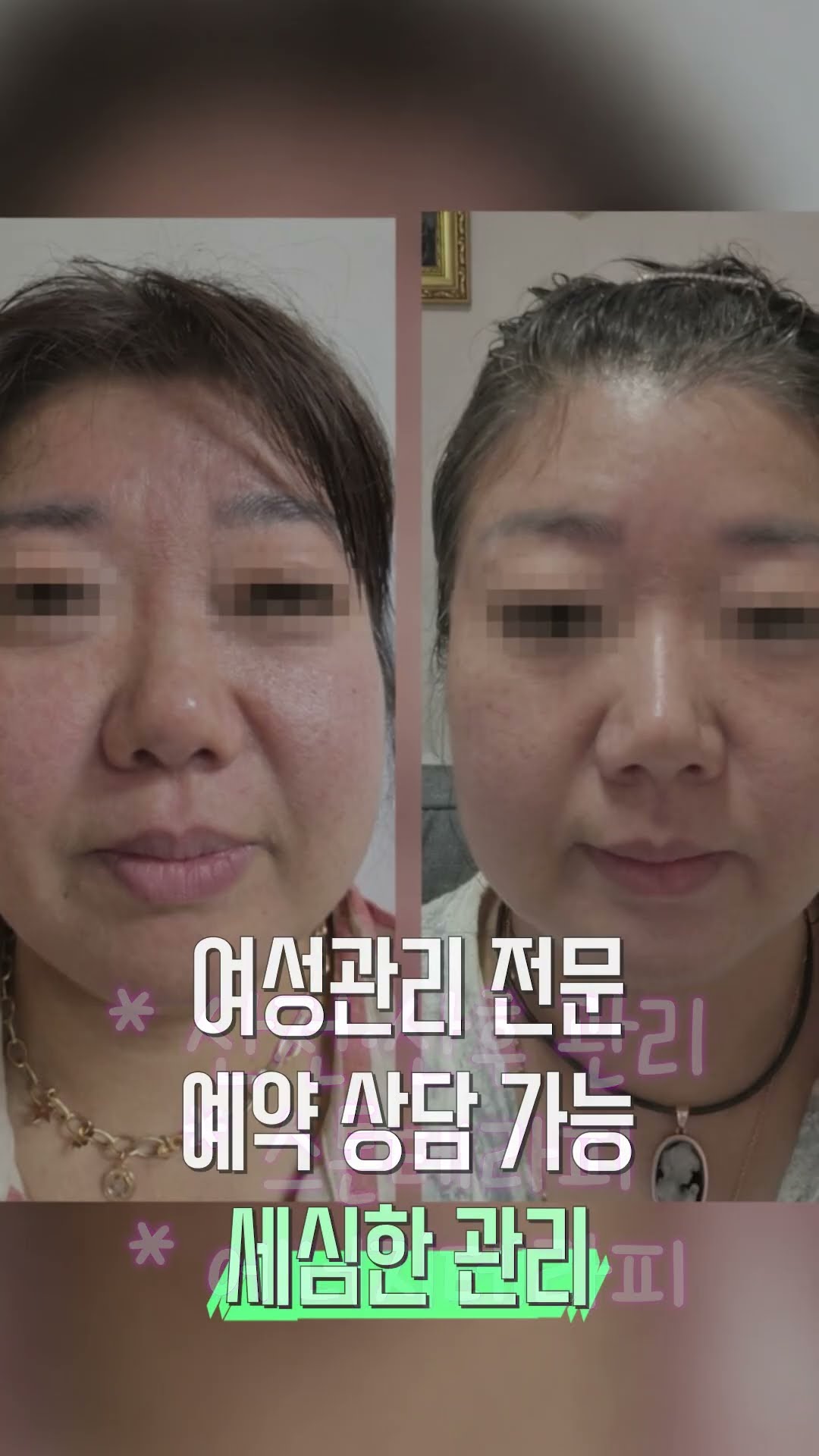💆‍♀️피부 + 체형 동시 해결! 더미다움 에스테틱에서 찐-힐링 받고 왔어요! #더미다움스킨엔바디 #과천피부관리 #과천체형관리 #산전관리 #산후관리 #스톤테라피 #에너지테라피 #여성관리전문 #피부관리 #체형관리 #에스테틱 #과천에스테틱