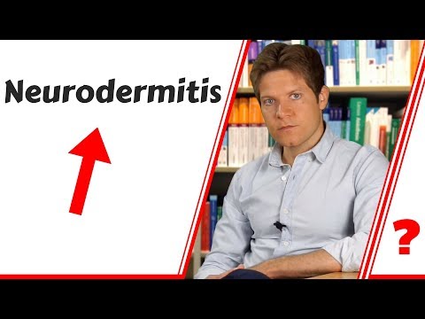 Der Mittelpunkt der Schuppenflechte in kijewe Die Schuppenflechte die Anfangsform