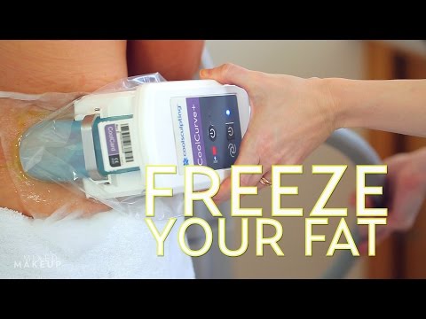 We Tried CoolSculpting in Los Angeles! | #TheSASS with Susan and Sharzad Video