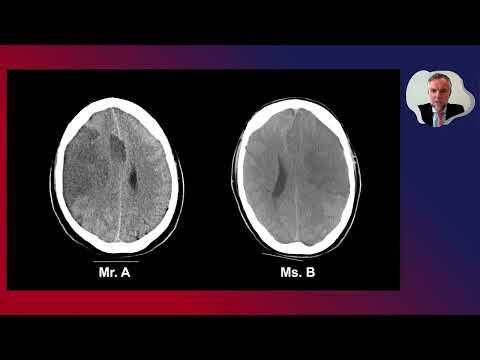 Management of Space-Occupying Brain Infarction