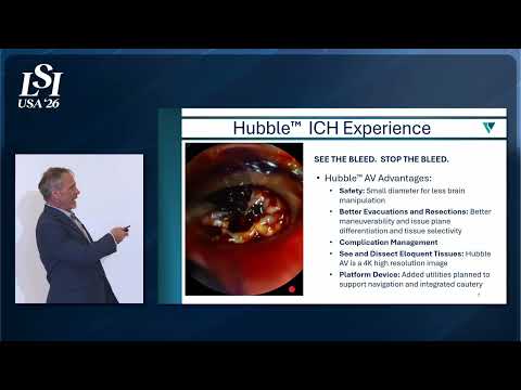 Pete Davis, Viseon Inc - 4K video imaging for minimally invasive spine surgery | LSI USA '26