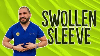 Swollen Sleeve | Gastric Sleeve Surgery | Questions and Answers