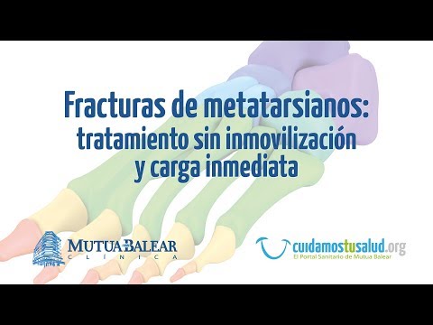 AUDIOVISUAL FRACTURAS METATARSIANOS