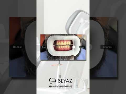 Klinik videolarımızı izleyin