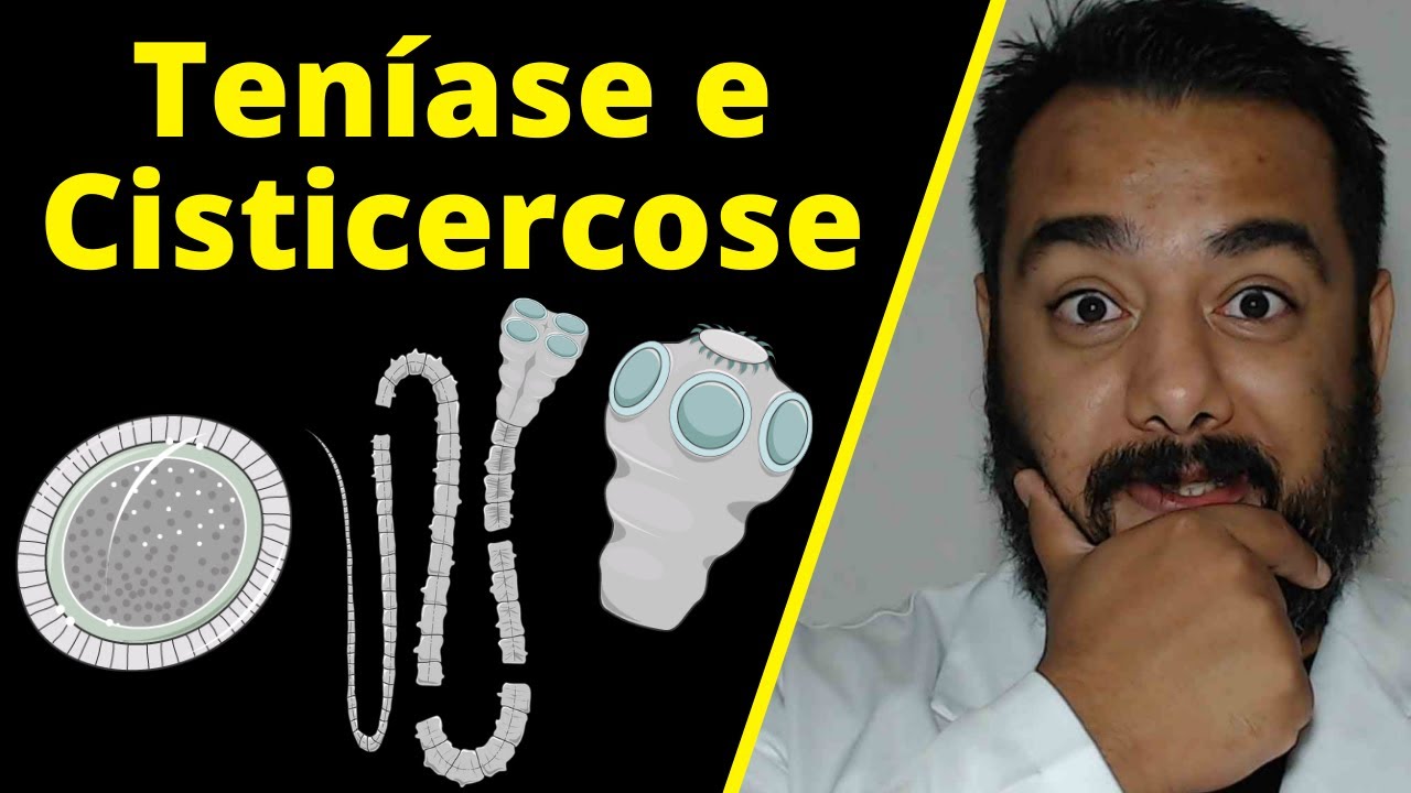 Teníase e Cisticercose (Taenia solium e saginata): parasitologia, ciclo de vida, diagnóstico