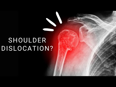 Posterior Shoulder Dislocation: What is it? How Does It Happen?