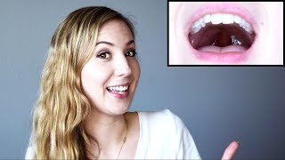 How to Raise Your Soft Palate and Open Your Voice