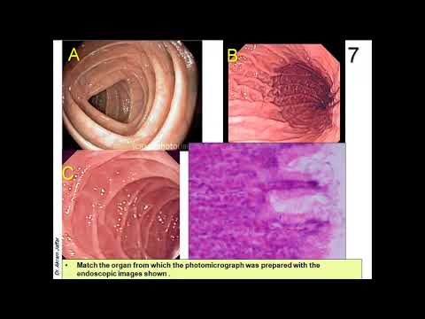 Anatomie des Gastrointestinaltrakts und der Harnwege