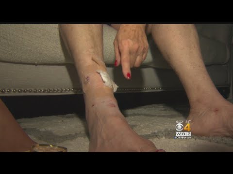 Fox Attacks In Middleboro Send 2 Women To The Hospital