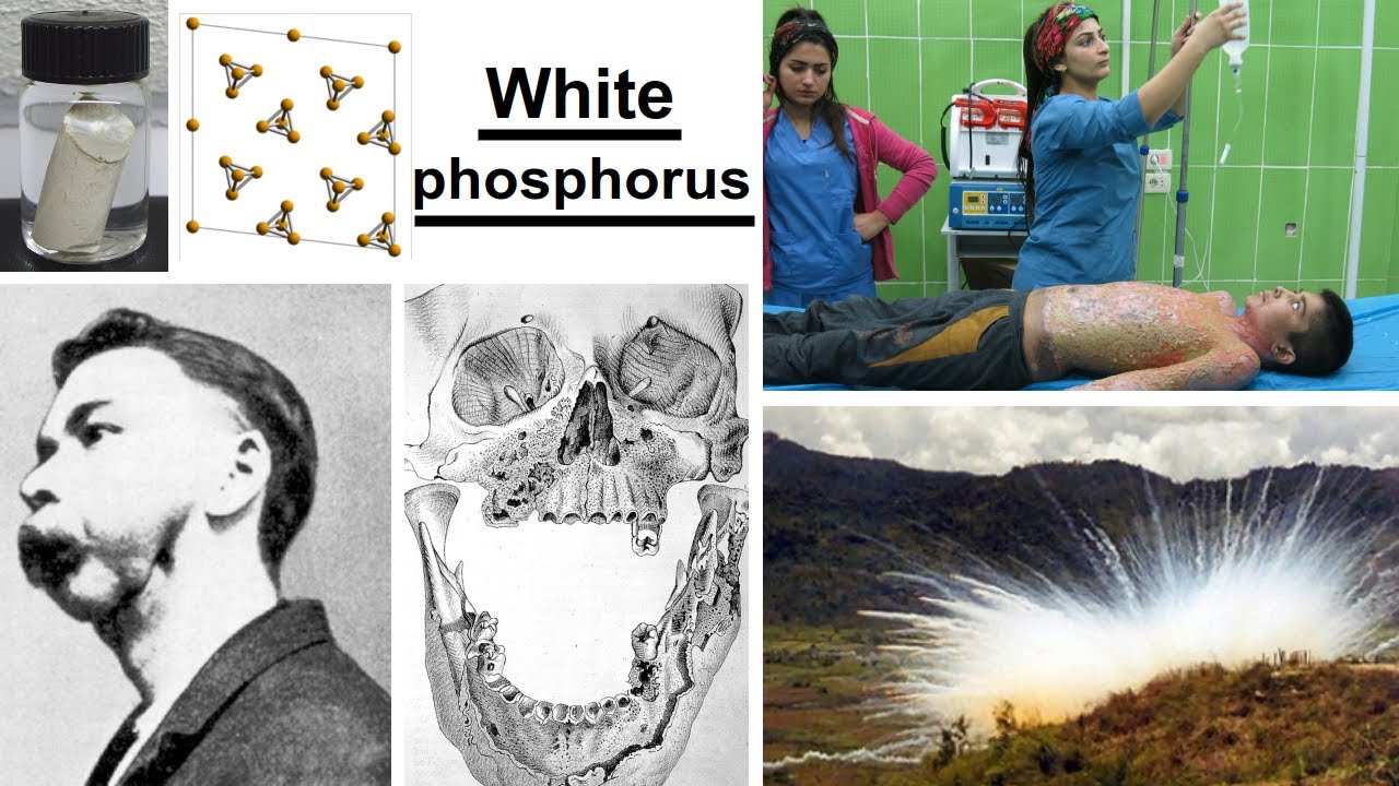 white phosphorus