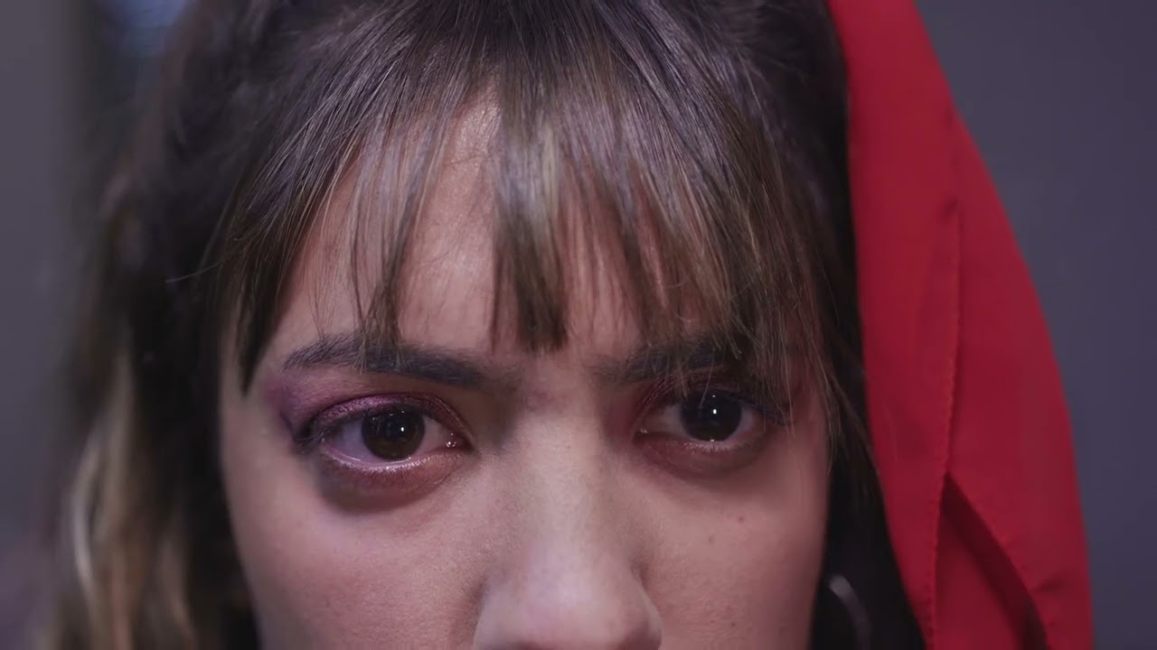 Dysmorphia
