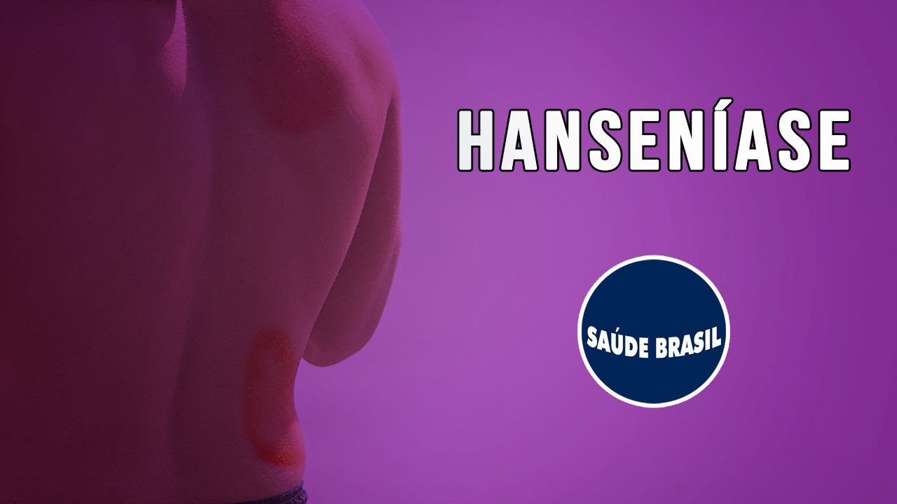 HANSENÍASE | SÉRIE SAÚDE BRASIL