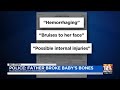 Police: Father Broke Baby's Bones