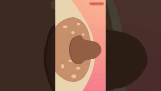 Download lagu Begini Perubahan Payudara Selama Hamil dan Bersalin 🥰 #halobidan #viral #trending #youtubeshorts mp3 Download lagu Begini Perubahan Payudara Selama Hamil dan Bersalin 🥰 #halobidan #viral #trending #youtubeshorts mp3