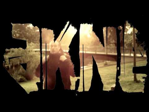 Akne - Kool, Aids & Frozen Pizza (VBT 8tel RR vs. Pimf) Royalfam Hook!