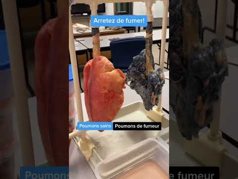 Do you smoke? Well, here's why you should stop... #tobacco #smoking #cancer #medicine #health #me...