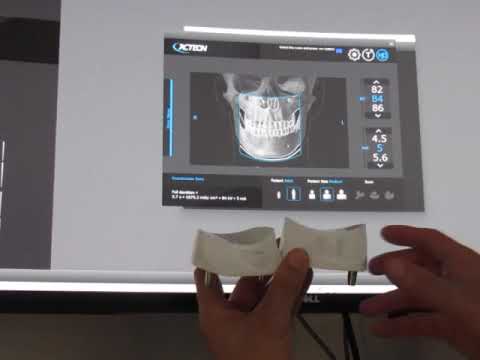 Chinrest application on Acteon's X-Mind Prime CBCT