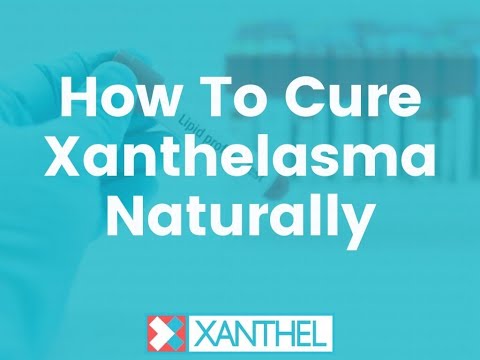 How To Cure Xanthelasma Naturally