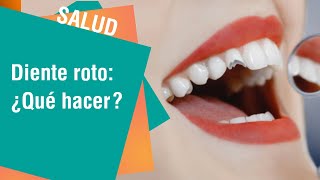 ¿Qué hacer cuando se nos quiebra un diente | Consejos para usted