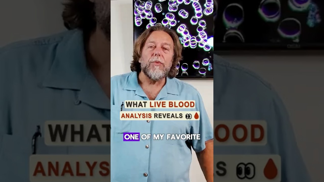 Live Blood Cell Analysis 🩸❤️🥰  #health #blood #test
