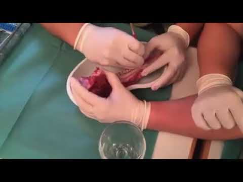 Daum Implant Classes Modul I  - Essen Juli 2017