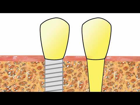 Definition der Knieverletzung Dass nehmen für Schwindel in Osteochondrose