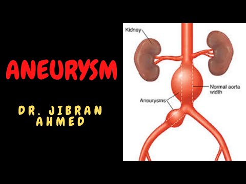 MYOCARDIAL INFARCTION II HEART II SYSTEMIC PATH II ROBBINS 10TH E II PATHOLOGY LECTURE