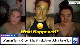 Woman Turns Green Like Shrek After Using Fake Tan