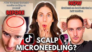 Can You Grow Back Hair With Scalp Microneedling? Does Scalp Microneedling Work?
