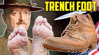 (109 yr old) The WW1 boot behind 75,000 trench foot casualties