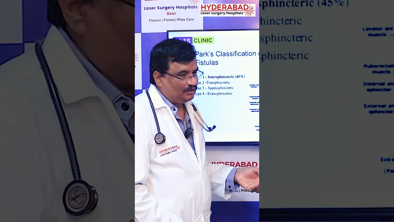 Fistula Laser Treatment Video 1