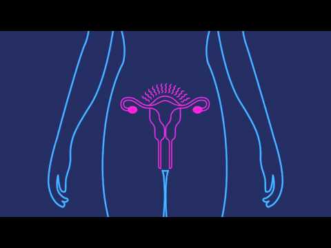 How Effective is the Birth Control Shot | Planned Parenthood Video