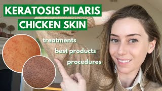 Keratosis Pilaris: How to treat dry bumpy skin aka chicken skin! | Dr. Shereene Idriss
