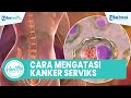 Cara Mengatasi Kanker Serviks Dengan Metode Dr Ibnu Sina