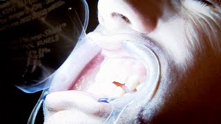 What happens when you don't brush your teeth? - Bang Goes The Theory - BBC