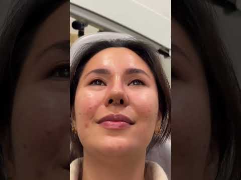 Revision Rhinoplasty in Istanbul