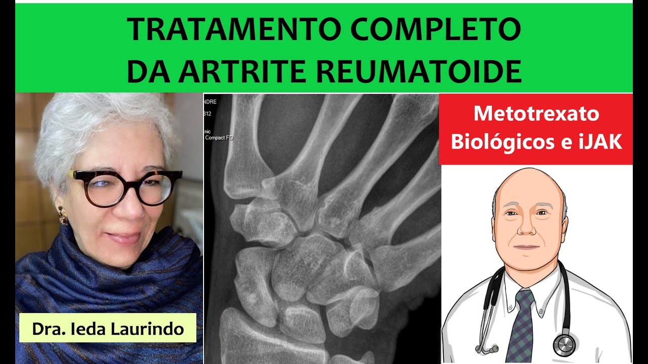 Os tratamentos para artrite reumatoide que funcionam com segurança. COVID e vacinas na artrite.