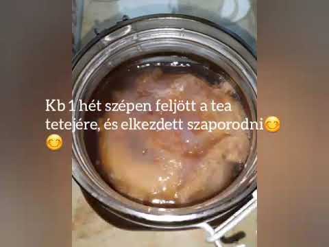 máj ízületi és izomfájdalmak könyök epicondylitis hatékony kezelés