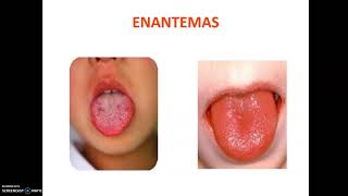 Semiología de piel, mucosas y anexos (Parte 2)