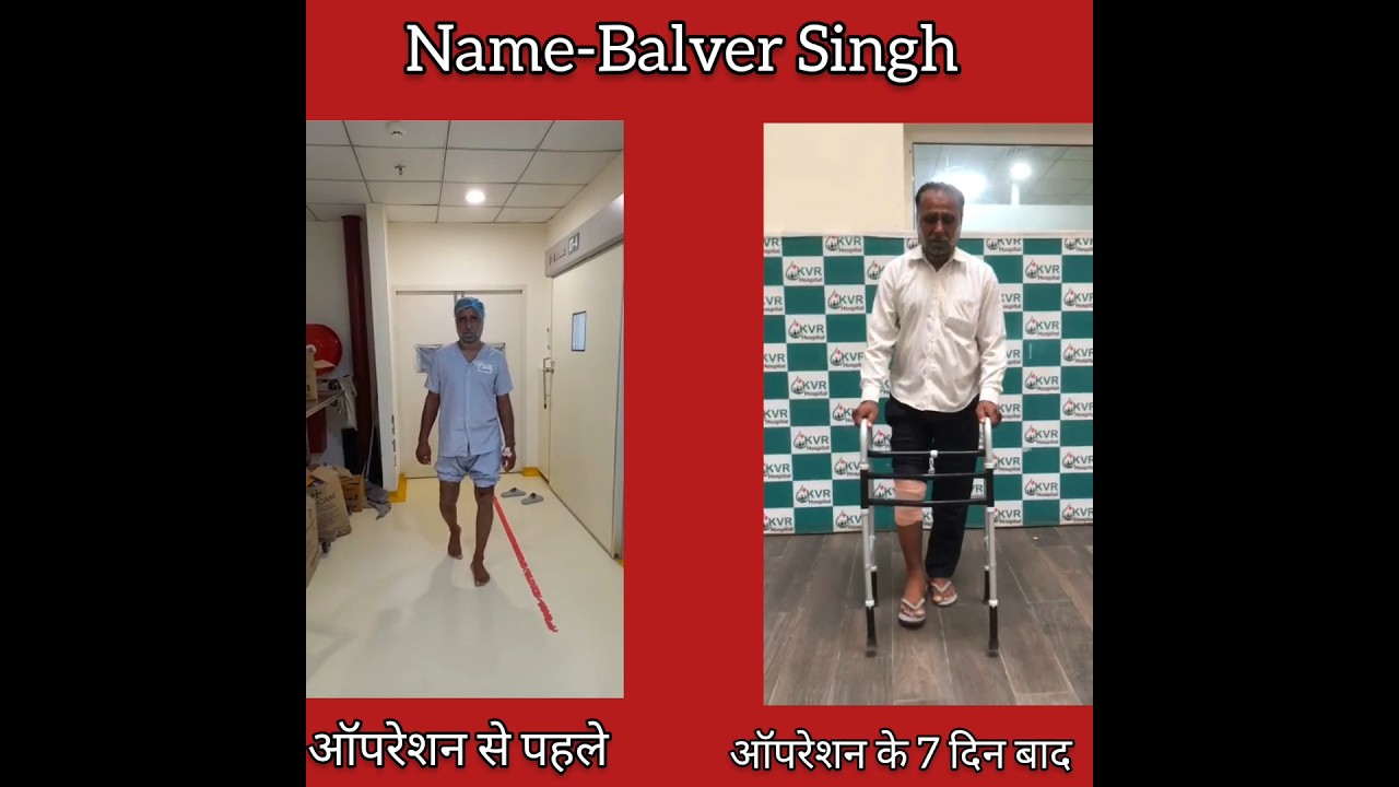 Knee Replacement Surgery - Pt name Balveer Singh #kneepain #kneereplacement #drtarunsolanki